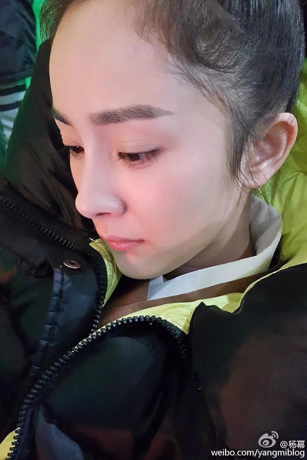 90后集体脱发变秃了…姑娘 请珍惜你的秀发!