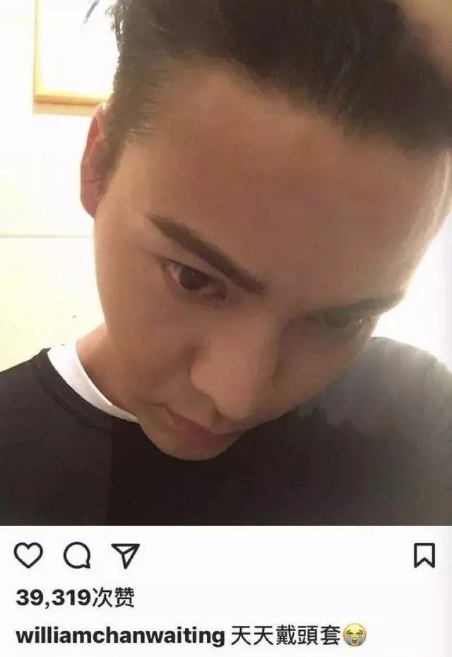 90后集体脱发变秃了…姑娘 请珍惜你的秀发!