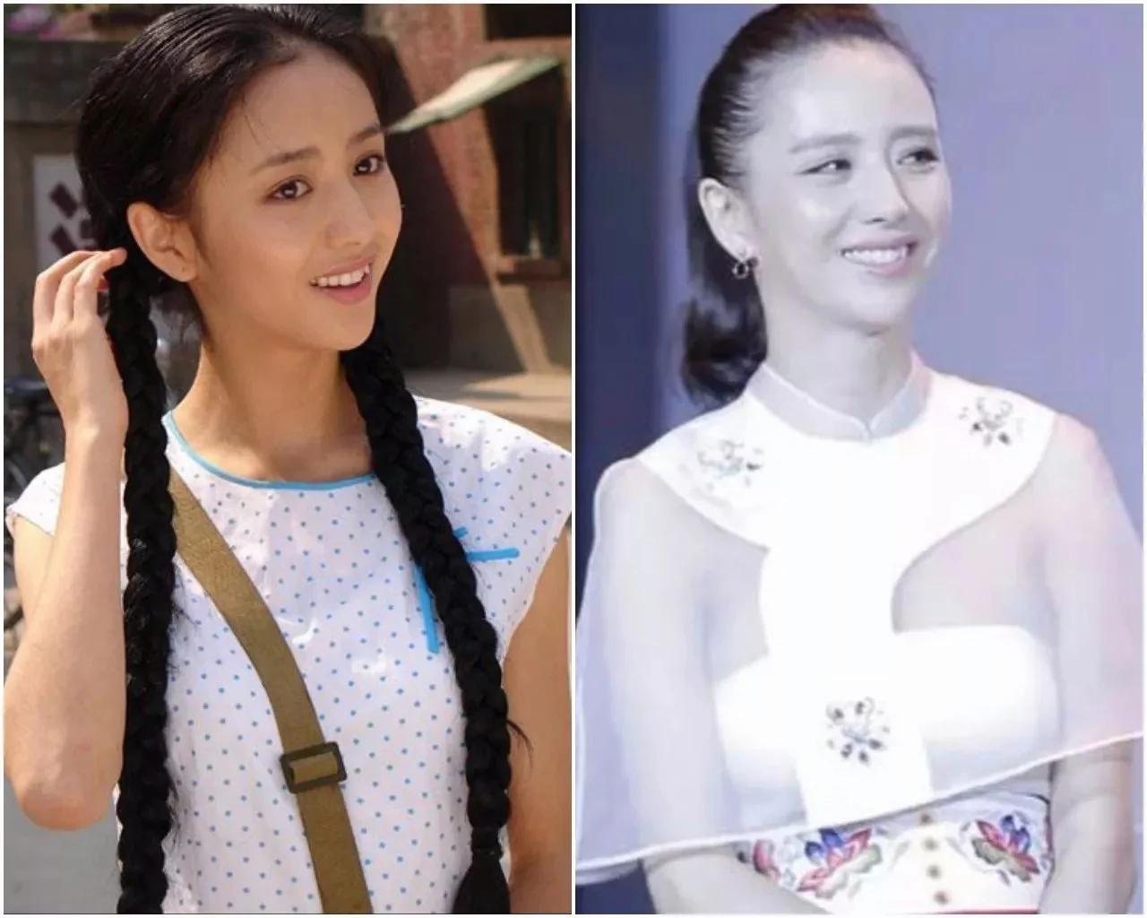 90后集体脱发变秃了…姑娘 请珍惜你的秀发!