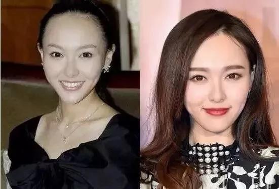 90后集体脱发变秃了…姑娘 请珍惜你的秀发!