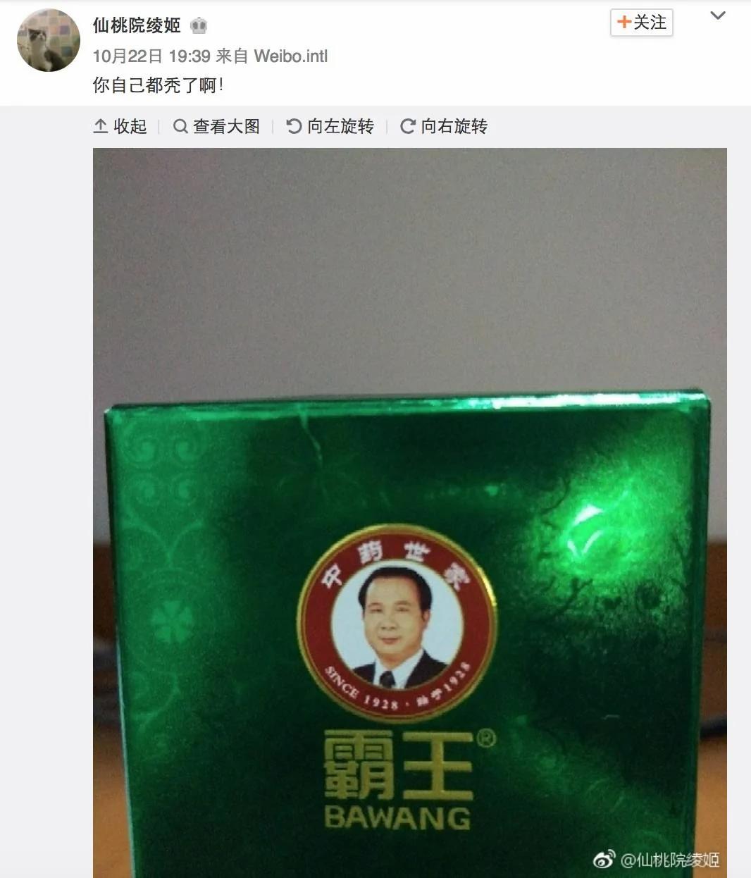 90后集体脱发变秃了…姑娘 请珍惜你的秀发!