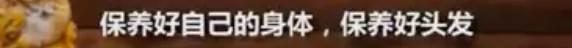 90后集体脱发变秃了…姑娘 请珍惜你的秀发!