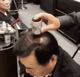 90后集体脱发变秃了…姑娘 请珍惜你的秀发!
