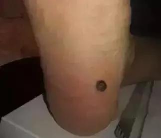 脚上的生命密码 人手一份 建议收藏!