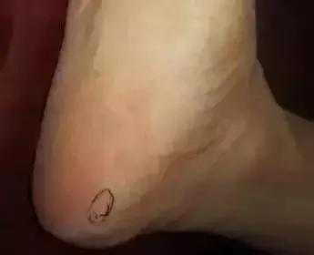 脚上的生命密码 人手一份 建议收藏!