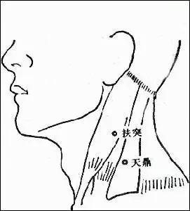 穴位养生法来了 一个穴位解决一种病