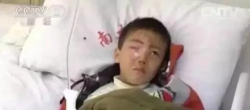 警惕!男童不经意玩这东西 20分钟眼珠被完全溶解