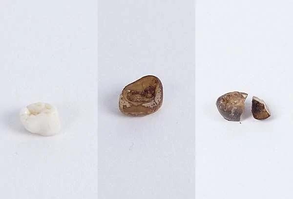 可乐真能用来洗马桶?专家用“牙齿”做实验 浸泡2天 牙齿变“这样”!