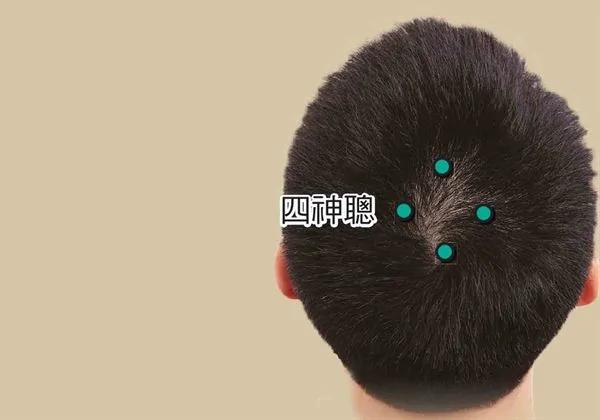 偏头痛、晕眩缠身?一把梳子按摩这4穴位助改善