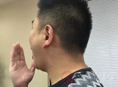 口臭按摩什么穴位 中医按摩治口臭的方法