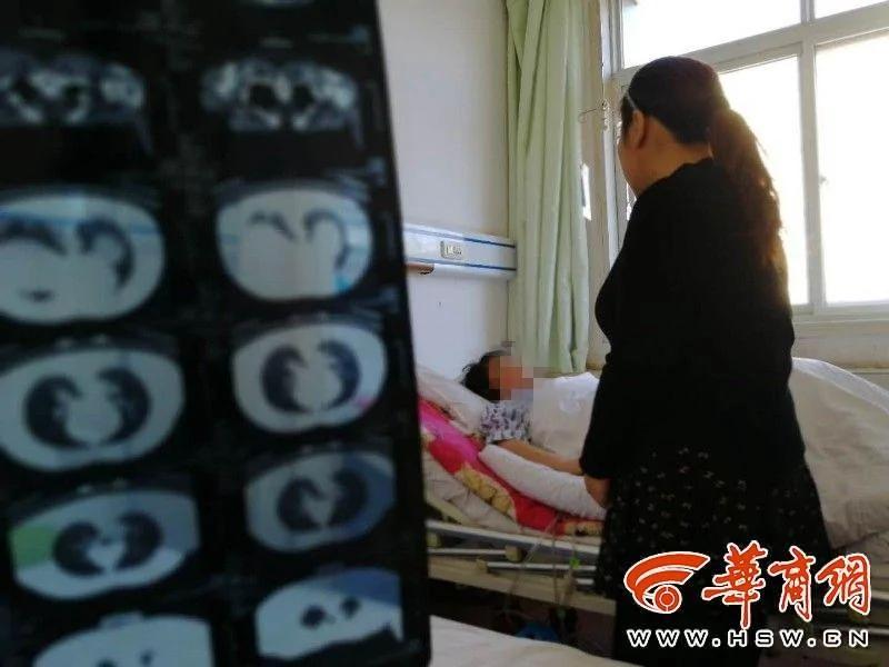 女子肺里住长辣椒 医生看到都震惊了