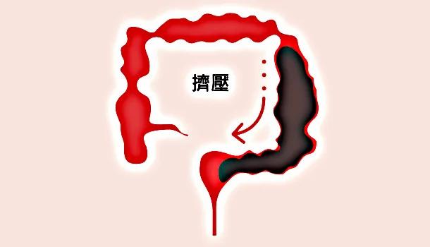 【图解知识】了解大肠日常运作