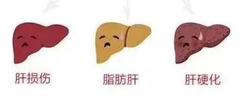 医生:肝脏有“三怕” 两个伤肝坏习惯 需改正!