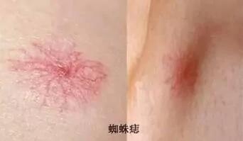 医生:肝脏有“三怕” 两个伤肝坏习惯 需改正!