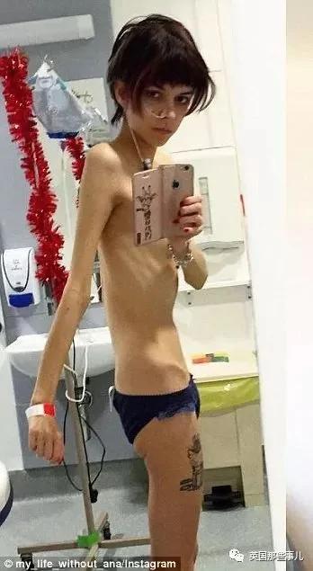 她在网上分享自己的赘肉 却感动了无数网友