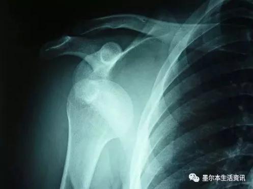 小伙和父亲正在庭院喝茶 突然一条鲨鱼从天而降!