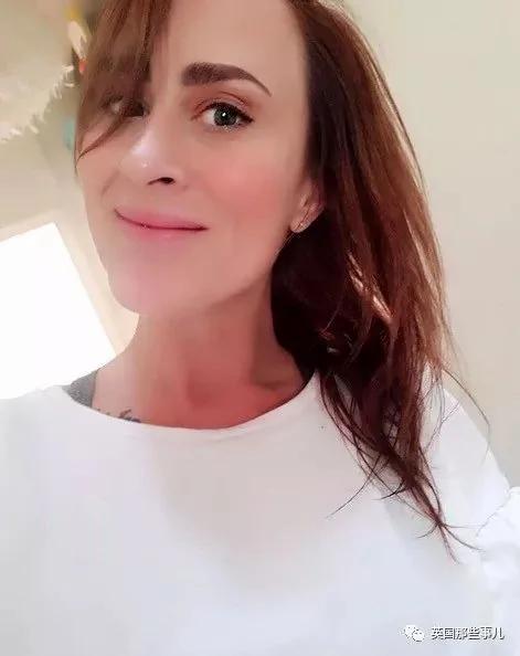 整容医师们集体蒙圈儿了!欧美妹子又有新的追求