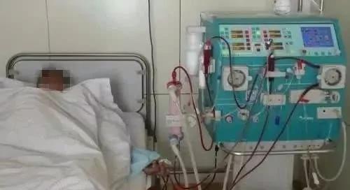 碰了下这动物 男子高烧4天险没命