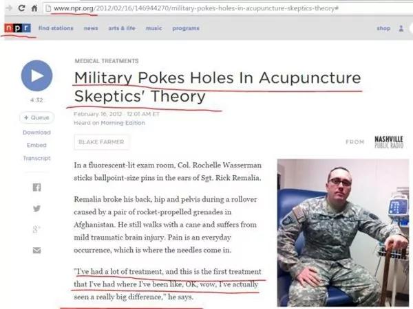 战场针灸:美军用中医针灸戳痛了谁?(反躬自问)