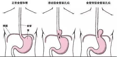 注意!千万别再劝别人"多喝热水"!有可能是在害Ta