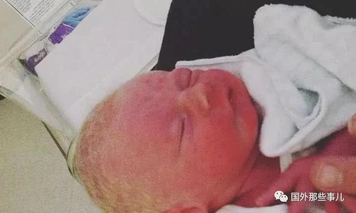 丈夫结扎八年 妻子腹痛检查16分钟后生了一娃