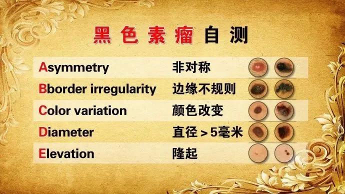 19种癌症的最早信号 提前知道能救命!