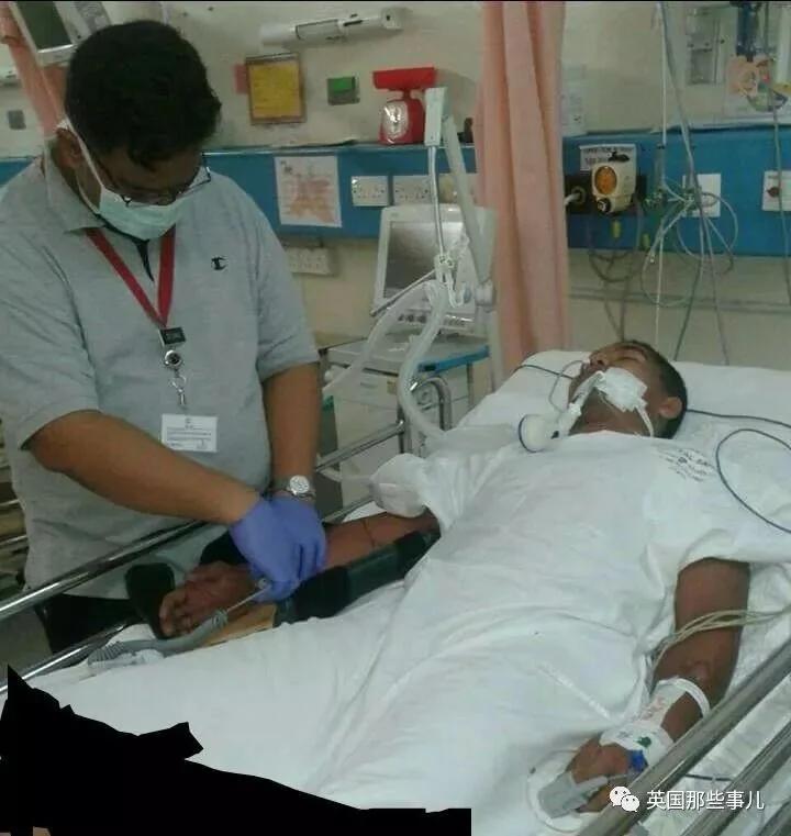 他被眼镜王蛇咬了8次都有惊无险 最后一次耗尽运气!