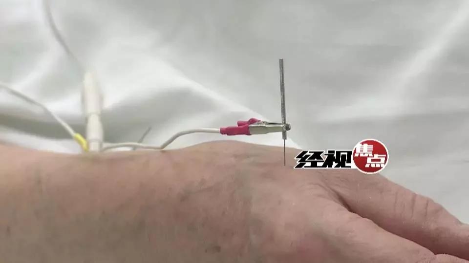 36岁女子睡觉尿床 原因竟是咽腔缩小睡觉打鼾