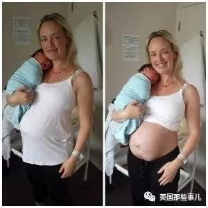 生完孩子肚子依然很大?这才是产后最真实的状态