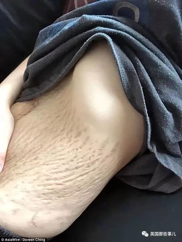 生完孩子肚子依然很大?这才是产后最真实的状态