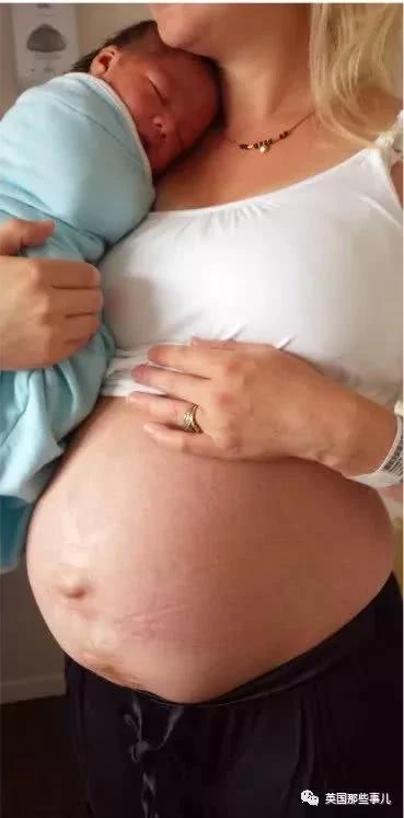 生完孩子肚子依然很大?这才是产后最真实的状态