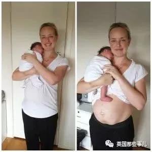 生完孩子肚子依然很大?这才是产后最真实的状态