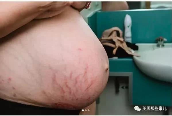 生完孩子肚子依然很大?这才是产后最真实的状态