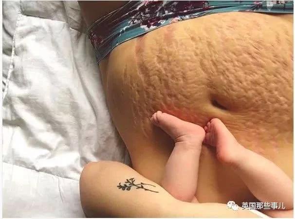 生完孩子肚子依然很大?这才是产后最真实的状态