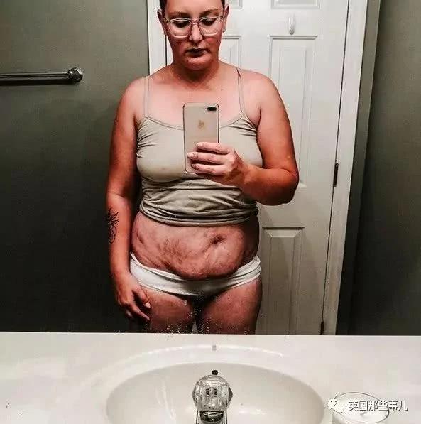 生完孩子肚子依然很大?这才是产后最真实的状态