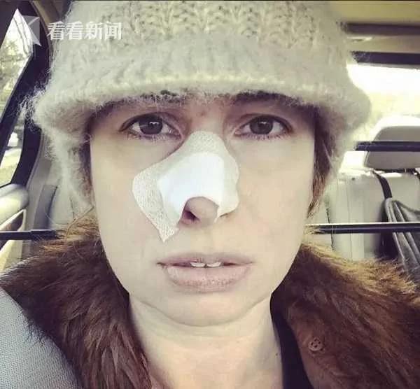 狗的报恩! 女子收养流浪狗 被闻出皮肤癌救回一命!
