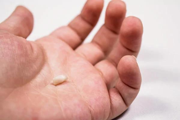 不是年纪大才会掉牙牙齿3症状立刻警觉