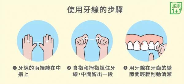 不是年纪大才会掉牙牙齿3症状立刻警觉