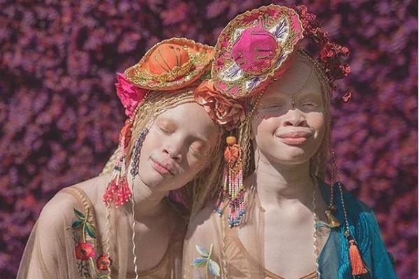 奇异的花朵!“白化病”双胞胎姐妹罕见的美丽横扫时尚界 还肩负一重要使命!
