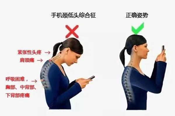 你还在低头玩儿手机吗?这些动作教你减少颈椎压力
