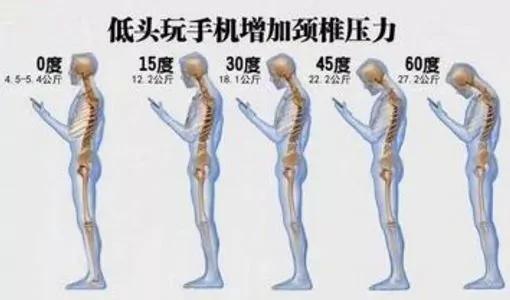 你还在低头玩儿手机吗?这些动作教你减少颈椎压力