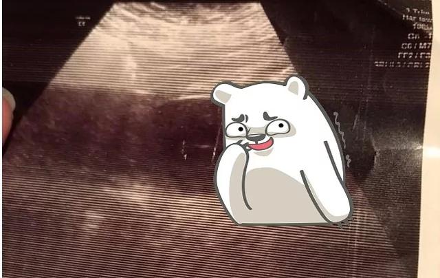 产后3月肚痛10多天医生一看傻眼了 都是…