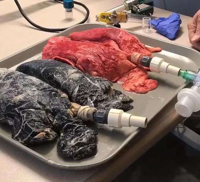 慎入:她用20年老烟民的肺和一个健康肺做试验 吓傻…