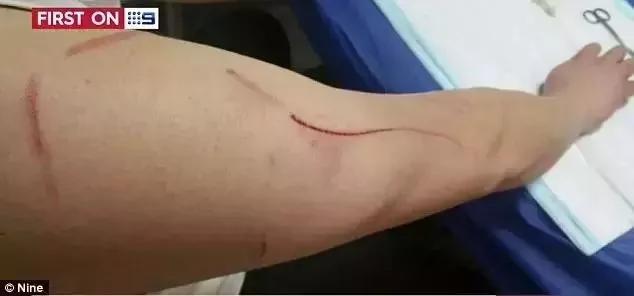 澳洲人民快要被袋鼠打残了…招招致命啊… !