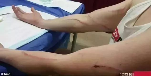 澳洲人民快要被袋鼠打残了…招招致命啊… !