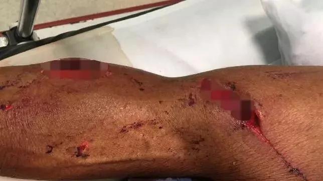 澳洲人民快要被袋鼠打残了…招招致命啊… !