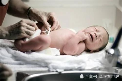 厌食女子仅25公斤 医生说生不了娃 增肥后连生俩娃!