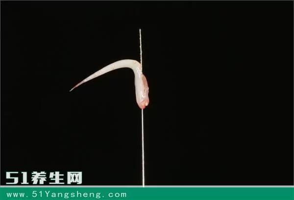 牙神經不能隨便殺?醫生說出了真相