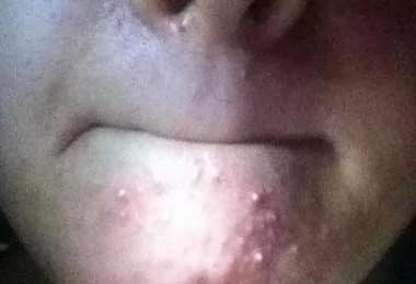 一旦肝不好 这2个部位首先会变臭!医生都害怕 一定要重视