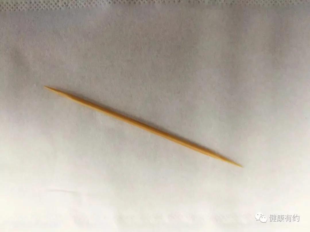 吃完饭都喜欢做这个动作 有人差点胃穿孔